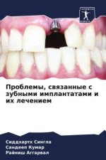 Problemy, swqzannye s zubnymi implantatami i ih lecheniem
