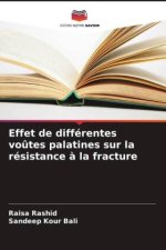 Effet de différentes vo?tes palatines sur la résistance ? la fracture