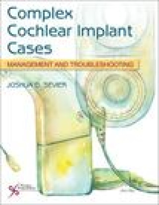 Complex Cochlear Implant Cases