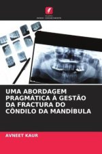 UMA ABORDAGEM PRAGMÁTICA ? GEST?O DA FRACTURA DO CÔNDILO DA MANDÍBULA