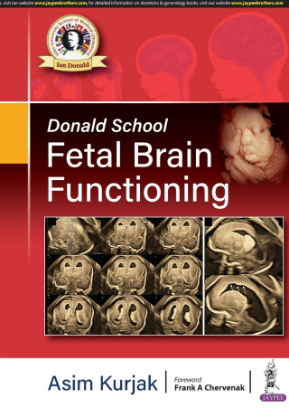 Donald School Fetal Brain Functioning