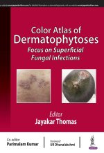 Color Atlas of Dermatophytoses