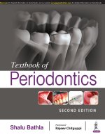Textbook of Periodontics