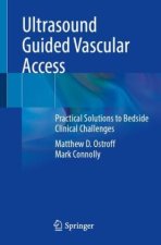 Ultrasound Guided Vascular Access