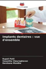 Implants dentaires : vue d'ensemble