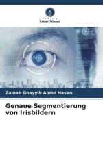 Genaue Segmentierung von Irisbildern