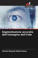 Segmentazione accurata dell'immagine dell'iride