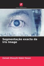 Segmentaç?o exacta da Iris Image