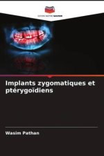 Implants zygomatiques et ptérygo?diens