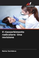 Il riassorbimento radicolare: Una revisione