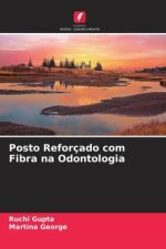 Posto Reforçado com Fibra na Odontologia