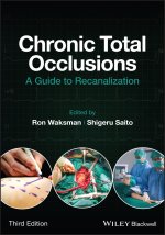 Chronic Total Occlusions