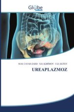 UREAPLAZMOZ