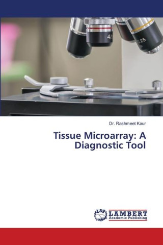 Tissue Microarray: A Diagnostic Tool