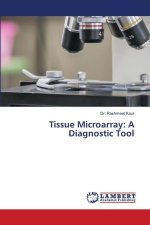 Tissue Microarray: A Diagnostic Tool