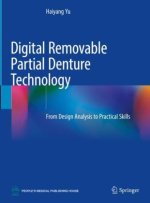 Digital Removable Partial Denture Technology