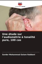 Une étude sur l'audiométrie ? tonalité pure, 100 cas