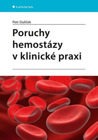 Poruchy hemostďż˝zy v klinickďż˝ praxi