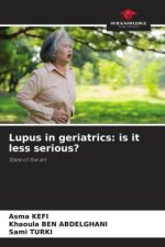 Lupus in geriatrics: is it less serious?