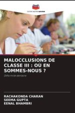 MALOCCLUSIONS DE CLASSE III : O? EN SOMMES-NOUS ?