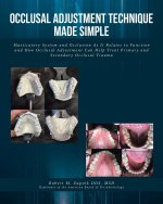 Occlusal Adjustment Technique Made Simple