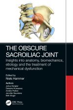 Obscure Sacroiliac Joint