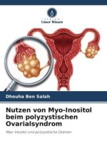 Nutzen von Myo-Inositol beim polyzystischen Ovarialsyndrom