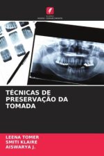 TÉCNICAS DE PRESERVAÇ?O DA TOMADA