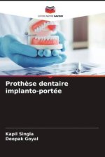 Proth?se dentaire implanto-portée