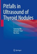 Pitfalls in Ultrasound of Thyroid Nodules