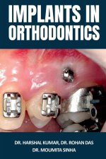 Implants in Orthodontics