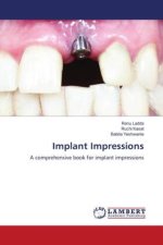 Implant Impressions