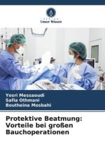 Protektive Beatmung: Vorteile bei großen Bauchoperationen