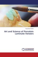 Art and Science of Porcelain Laminate Veneers