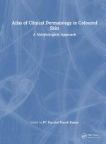 Atlas of Clinical Dermatology in Coloured Skin