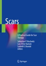 Scars