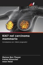 Ki67 nel carcinoma mammario