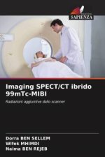 Imaging SPECT/CT ibrido 99mTc-MIBI