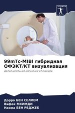 99mTc-MIBI gibridnaq OFJeKT/KT wizualizaciq