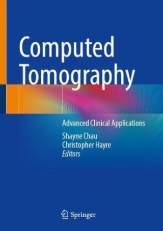 Computed Tomography