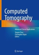 Computed Tomography