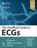 Unofficial Guide to ECGs