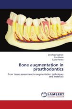 Bone augmentation in prosthodontics