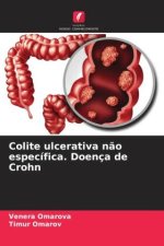 Colite ulcerativa n?o específica. Doença de Crohn