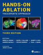 Hands-On Ablation, The Experts' Approach, Third Edition