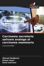 Carcinoma secretorio salivare analogo al carcinoma mammario