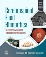 Cerebrospinal Fluid Rhinorrhea