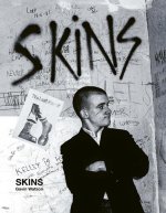 Skins: Gavin Watson