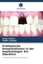 Prothetische Komplikationen in der Implantologie: Ein Überblick