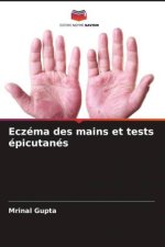 Eczéma des mains et tests épicutanés